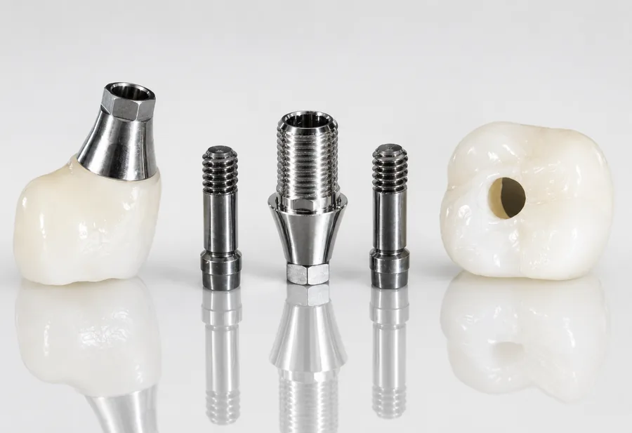 Implant restoration at Elite Smiles of La Jolla