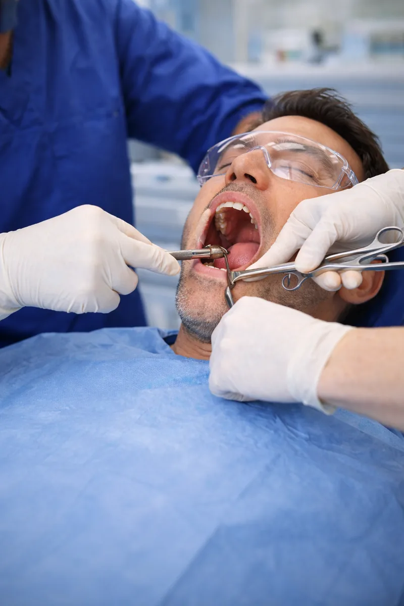 Oral Surgery at Elite Smiles of La Jolla